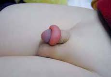 ban hep bao quy dau