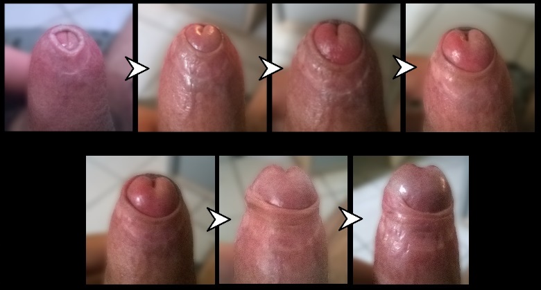 nong bao quy dau