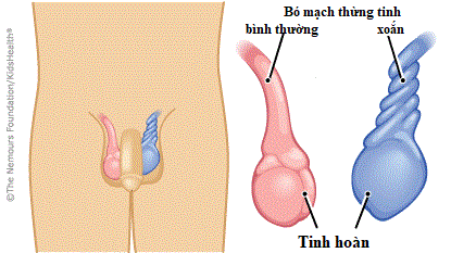 Xoắn tinh hoàn