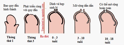 Chăm sóc bao quy đầu như thế nào