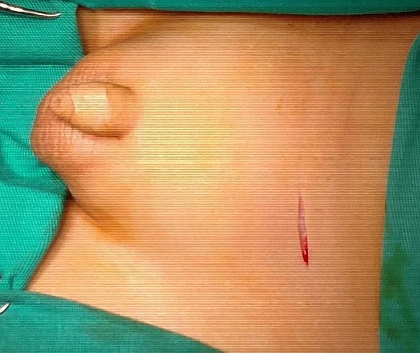 Duong mo an tinh hoan