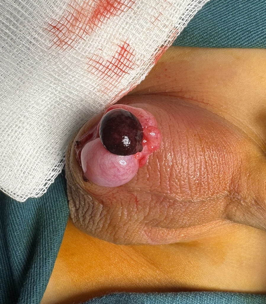 xoan phan phu tinh hoan 3