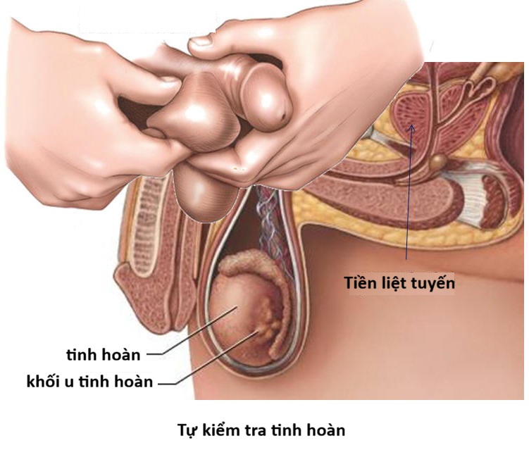 u tinh hoàn ở trẻ em